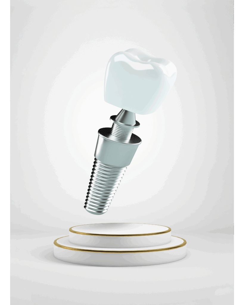 Dentista em Niterói – Mouzarte Odontologia em São Francisco 2 dentista em niterói